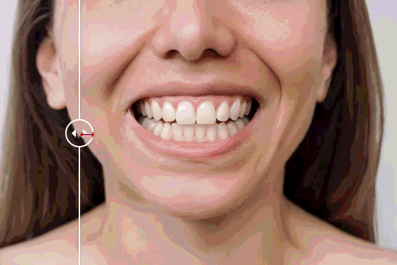 A mobile app showing a dental shade guide.